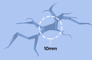 Plaster cracks in interior and exterior wall surfaces 